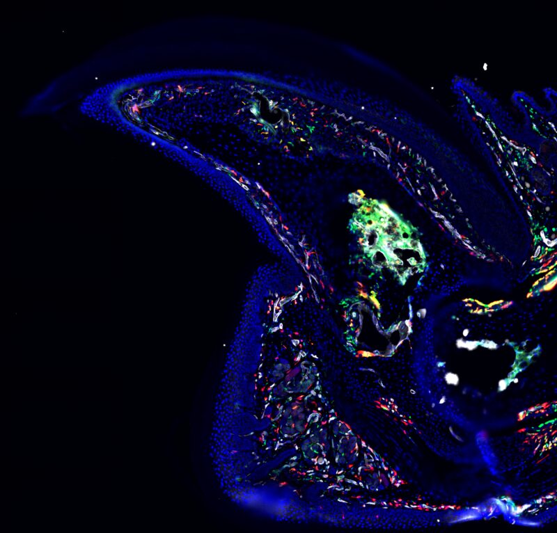 A colourful fluorescent microscope image shows the mouse digit tip from Eisner’s research.