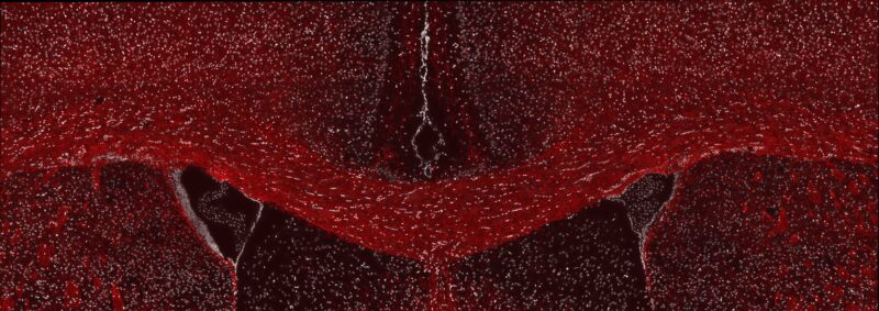 A fluorescent microscope image from Willis’ research shows healthy myelin in the adult mouse brain. The brain section has been labeled for a myelin protein (red) and cell nuclei (white).