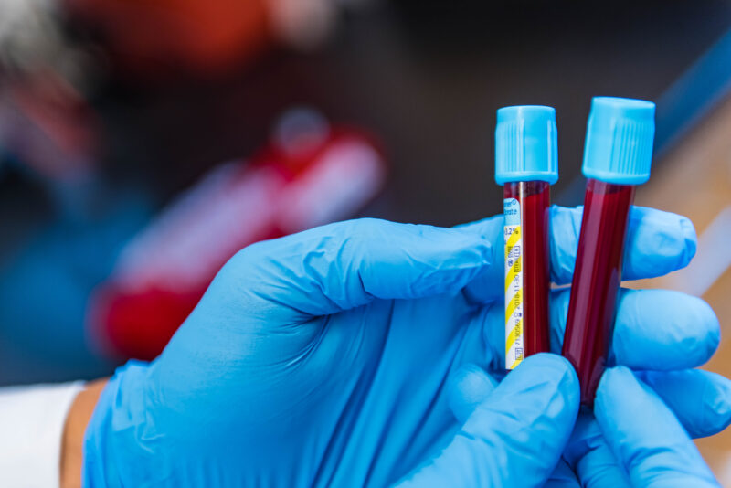A researcher, wearing gloves, holds two test tubes of blood.